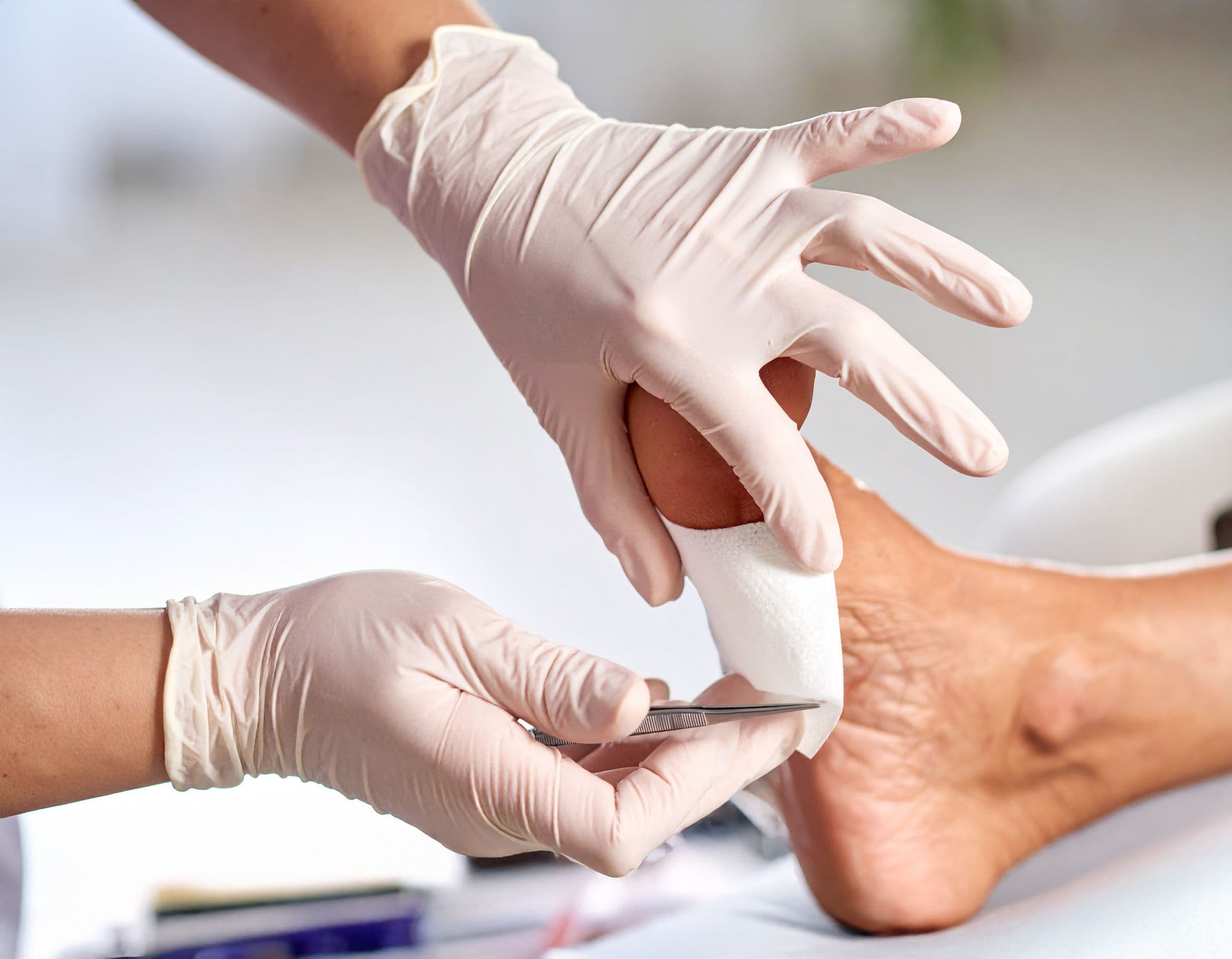 Pflegekraft mit Handschuhen, die einen Verband auf eine Wunde am Fuß eines älteren Patienten anlegt