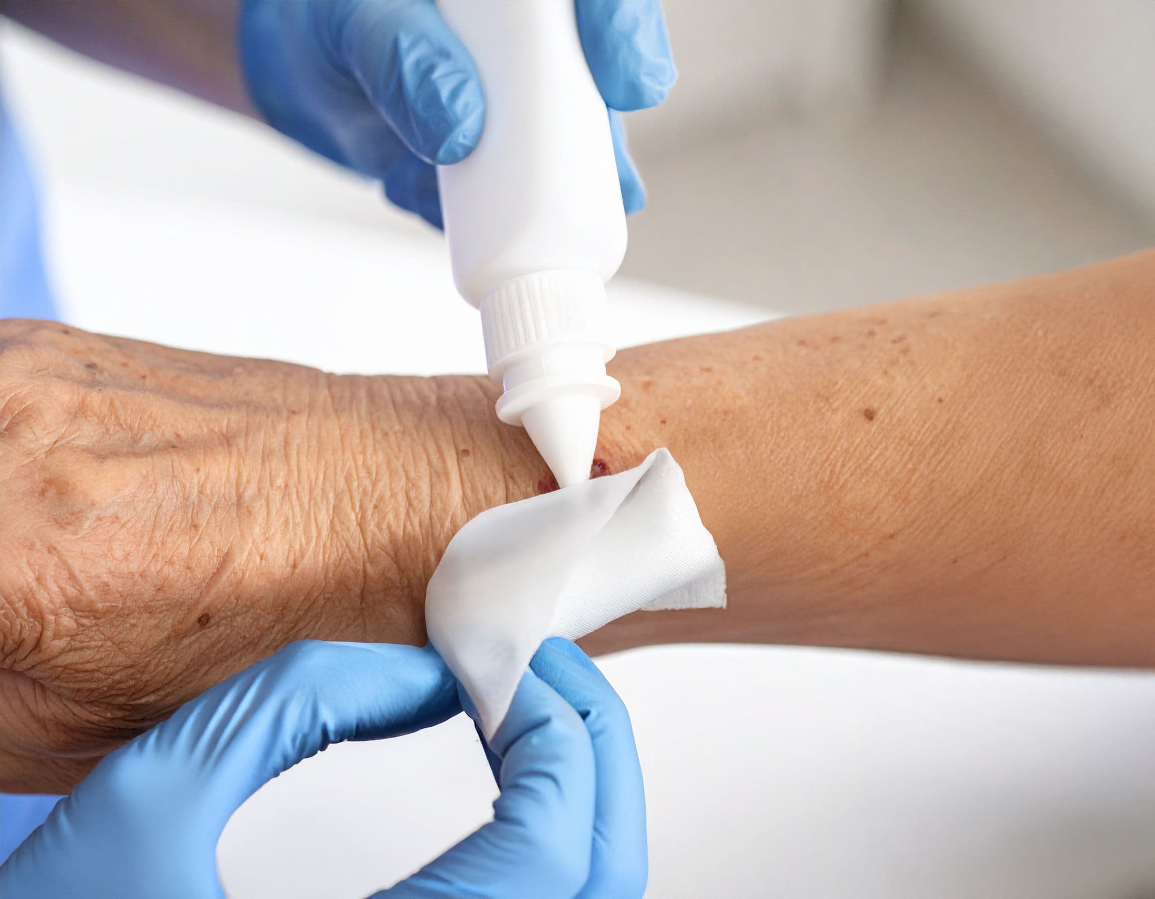 Pflegekraft in Handschuhen behandelt eine Wunde am Arm einer Seniorin