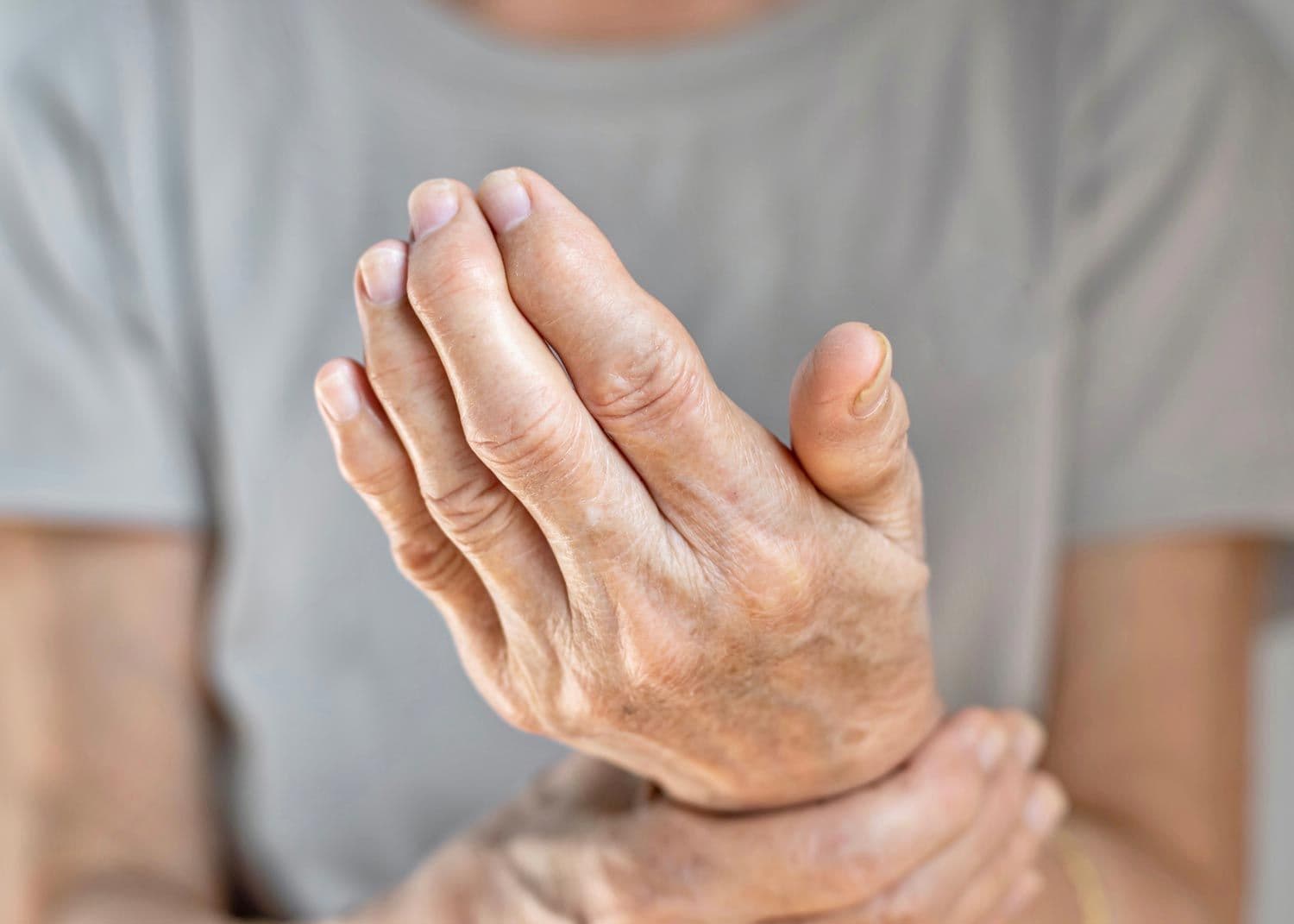 Nahaufnahme einer älteren Hand mit Polyarthritis, die von der anderen Hand gehalten wird